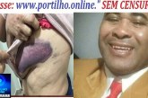 👉😱🚔🚒😪🚑Agressões em Coromadel 🚨🚔 LEI MARIA DA PENHA – AGRESSÃO VIOLENTA CONTRA MULHER DE 57 ANOS!