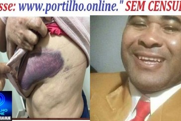 👉😱🚔🚒😪🚑Agressões em Coromadel 🚨🚔 LEI MARIA DA PENHA – AGRESSÃO VIOLENTA CONTRA MULHER DE 57 ANOS!
