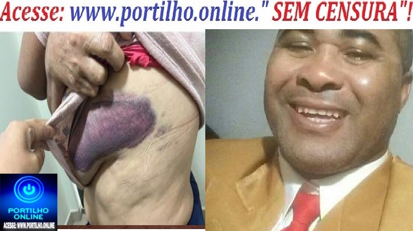 👉😱🚔🚒😪🚑Agressões em Coromadel 🚨🚔 LEI MARIA DA PENHA – AGRESSÃO VIOLENTA CONTRA MULHER DE 57 ANOS!